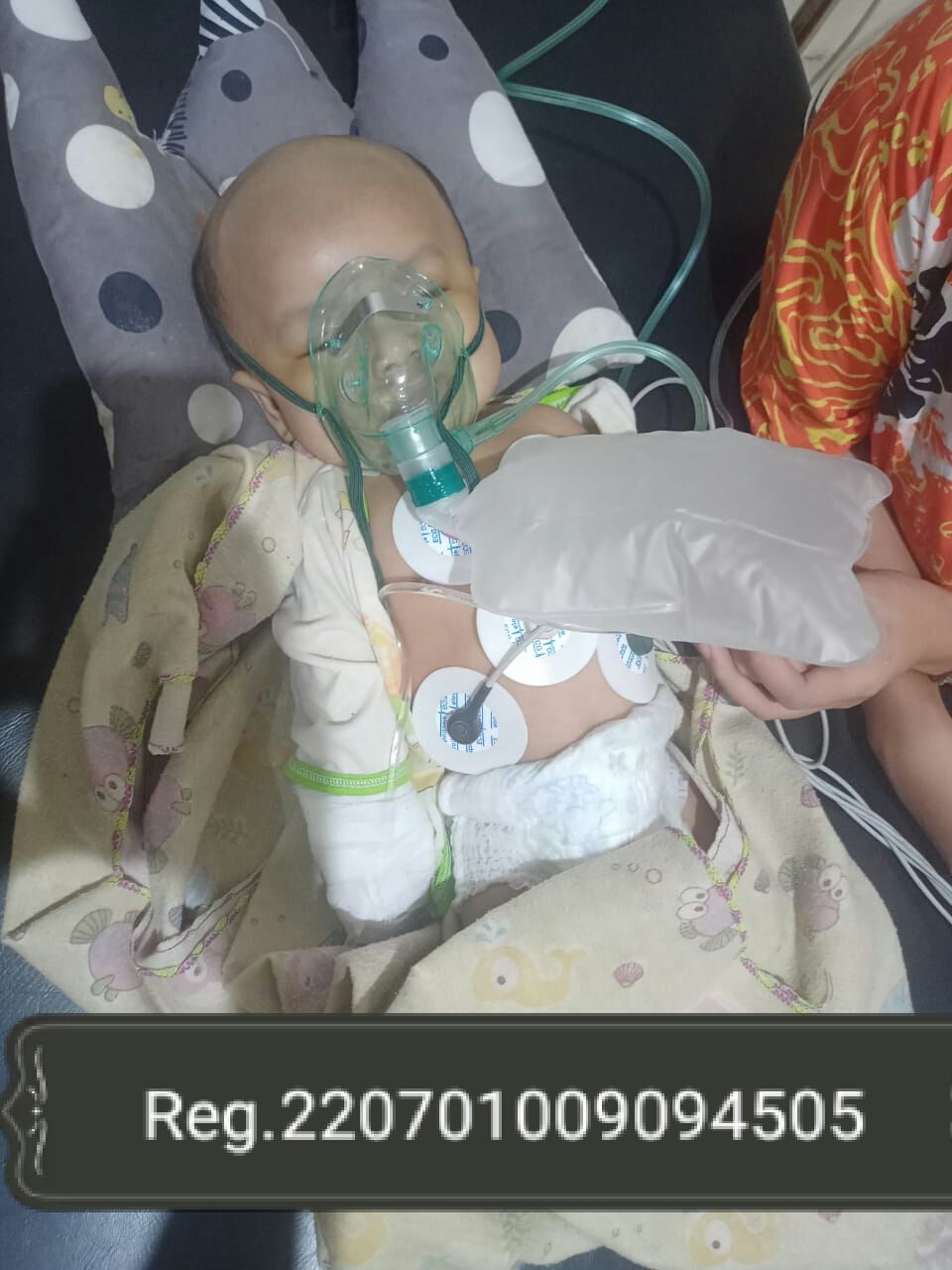 Bayi Pengidap Pembekuan Darah di Otak Sedang Menjalani Perawatan di RSU Raden Mataher Jambi 