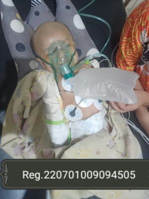 Bayi Pengidap Pembekuan Darah di Otak Butuh Bantuan Para Dermawan 